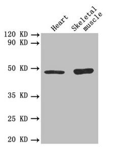 TGFB2 Antibody