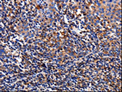 TTR Antibody