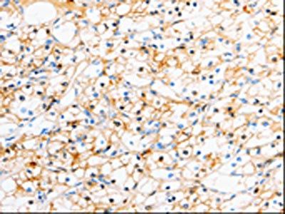 TTR Antibody