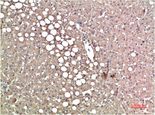 TTR Antibody