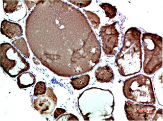 TTR Antibody