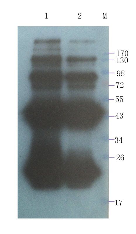 Transthyretin antibody