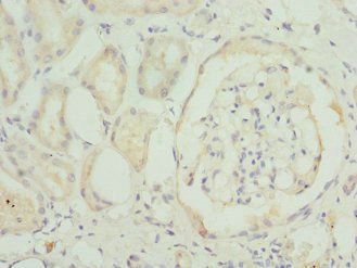 TRAPPC10 Antibody