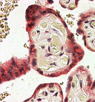 TRC8 Antibody