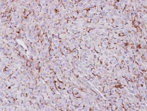 Trehalase Rabbit Polyclonal Antibody