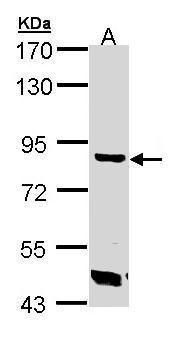 Trehalase Rabbit Polyclonal Antibody