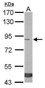 Trehalase Rabbit Polyclonal Antibody