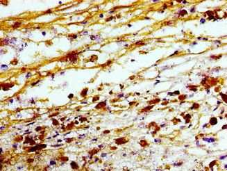TREM2 Antibody