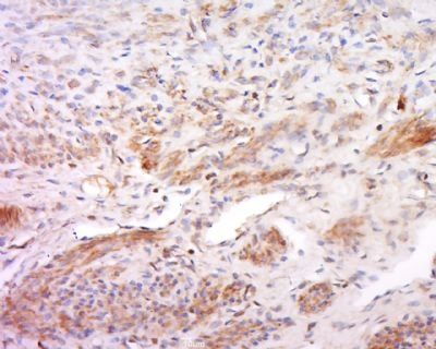 TREX2 Rabbit Polyclonal Antibody