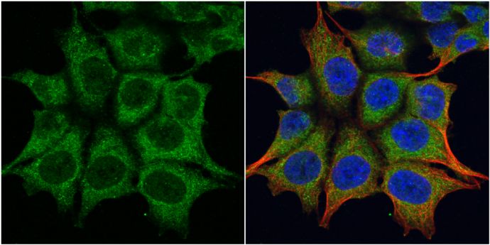 TRIM23 Rabbit Polyclonal Antibody