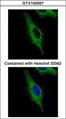 TRIM23 Rabbit Polyclonal Antibody