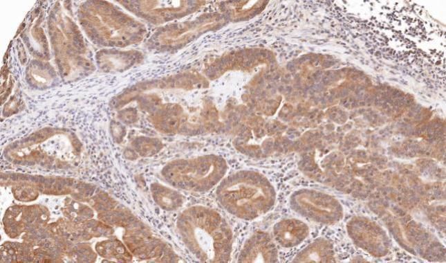TRIM23 Rabbit Polyclonal Antibody