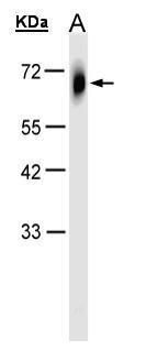 TRIM23 Rabbit Polyclonal Antibody