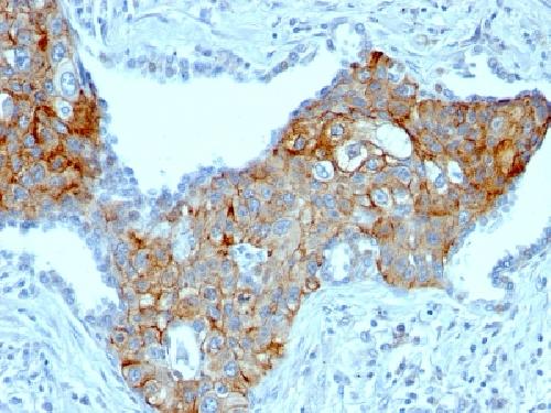 TRIM29 Antibody