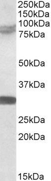 TRIM2 Antibody