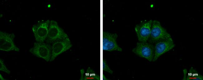 TRIM32 Rabbit Polyclonal Antibody