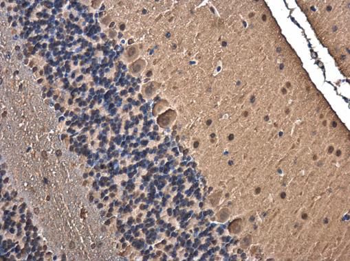 TRIM32 Rabbit Polyclonal Antibody