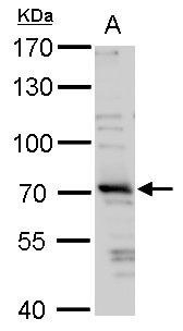 TRIM32 Rabbit Polyclonal Antibody