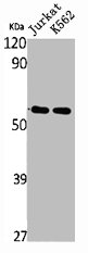 TRIM68 Antibody