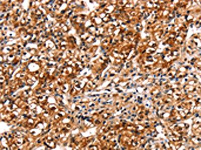 TRIM69 Antibody