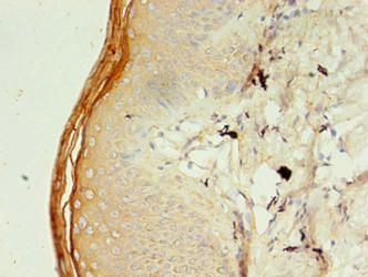 TRIM9 Antibody