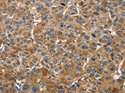 TRIP4 Antibody