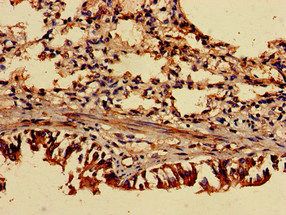 TRIP4 Antibody
