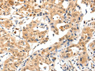 TPM2 Antibody