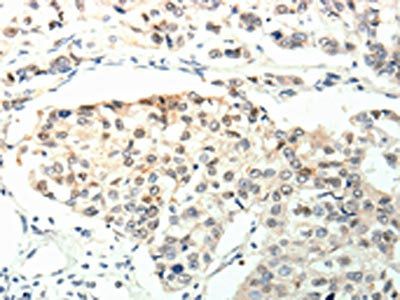 TPM2 Antibody