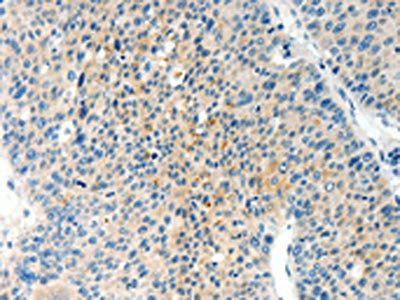 TPM2 Antibody