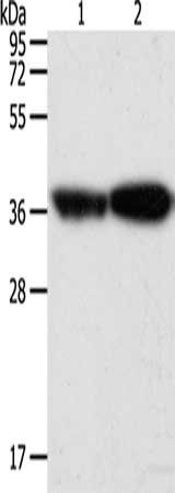 TPM2 Antibody