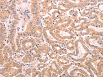 TRPC3 Antibody
