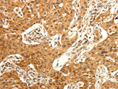 TRPC6 Antibody