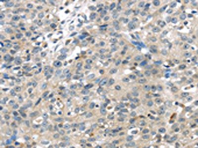TRPM2 Antibody