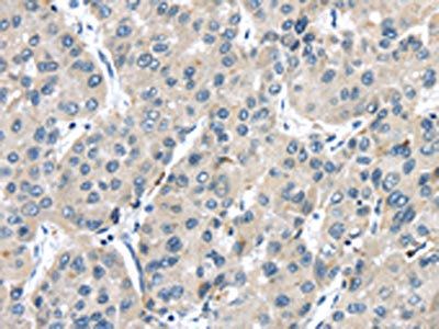 TRPM2 Antibody