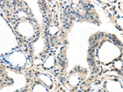 TRPM2 Antibody