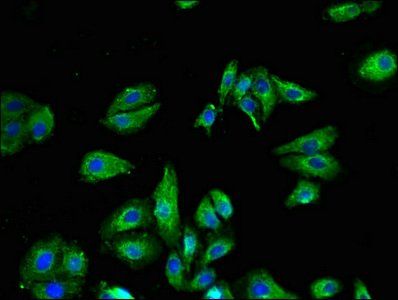 TRPV1 Antibody