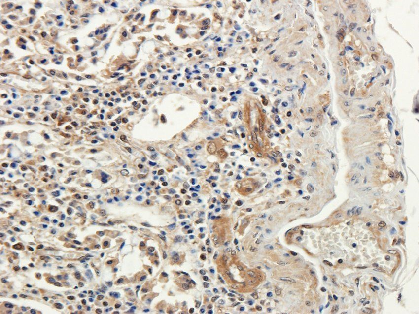 TRPV5 antibody