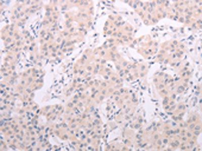 TSHR Antibody