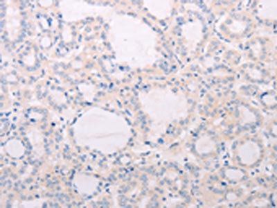 TSHR Antibody