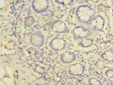 EIPR1 Antibody