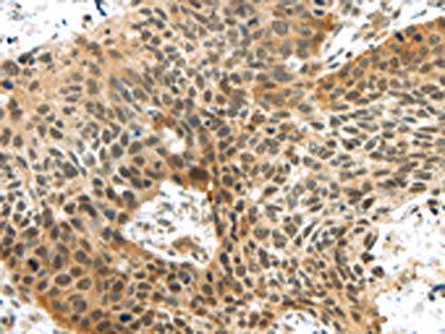 TTBK2 Antibody