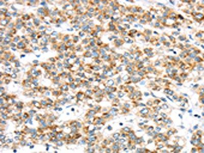 TTBK2 Antibody
