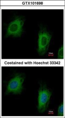 TTC1 Rabbit Polyclonal Antibody