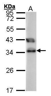 TTC1 Rabbit Polyclonal Antibody