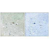 TTK Antibody