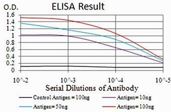 TTR Antibody