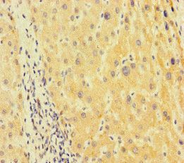 TUBA1B Antibody