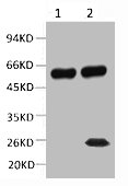 TUBB2A Antibody