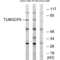 TUBGCP4 Antibody
